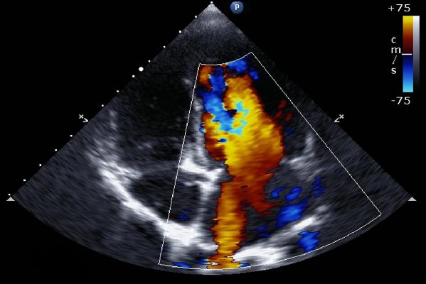 Echocardiography